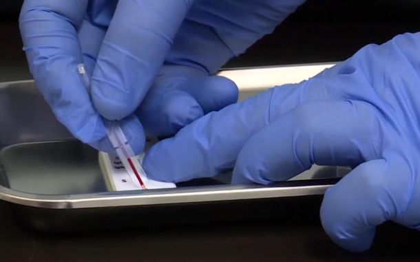 Researcher tests COVID-19 antibodies in blood 